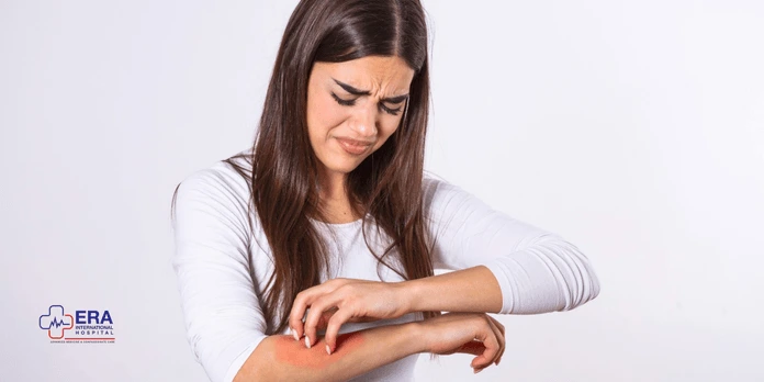 What is Malaria?