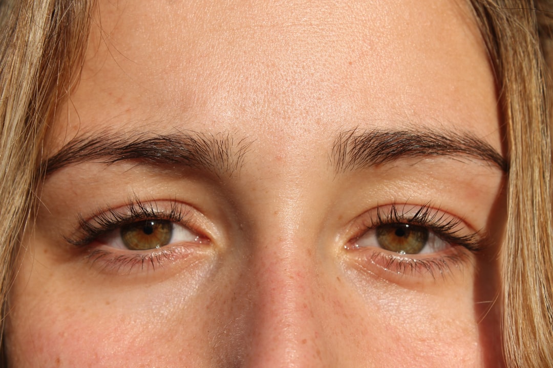 first time under eye filler phoenix az